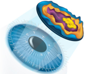 Laser Eye Surgery & Laser Eye Treatments